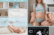 孕期如何有效避免羊水浑浊？科学预防指南守护母婴健康